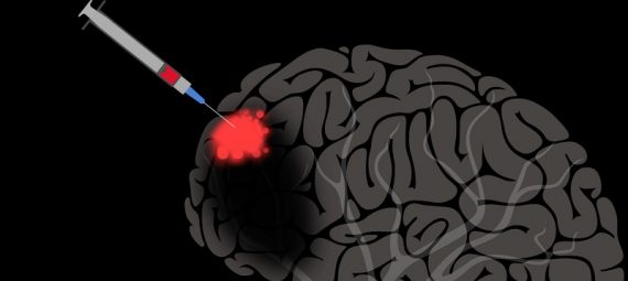 Delivering Drugs To The Brain Is Now A Reality